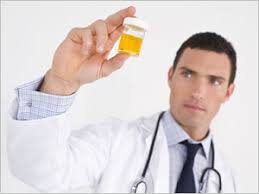 flacon pour analyse d urine en pharmacie