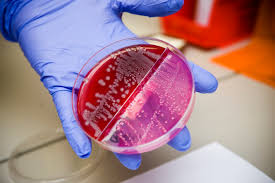 Image result for e.coli