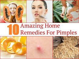10 amazing home remes for pimples