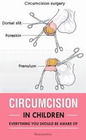 Btw, not sure why johnny austin described it as a kick in the nuts. 7 Circumcision Care Ideas Circumcision Circumcision Care New Baby Products