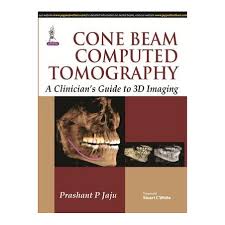 cone beam computed tomography jaju