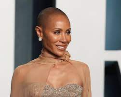 What is alopecia, Jada Pinkett Smith's ...