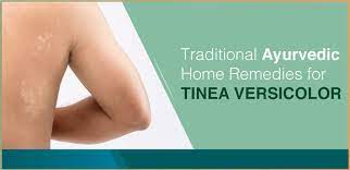 traditional ayurvedic home remes for