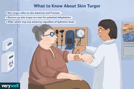 what is skin turgor