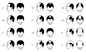 Hair Loss Chart
