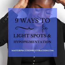 light spots hypopigmentation 9 ways