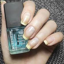 remedynails com images socialimages arzd20ct s