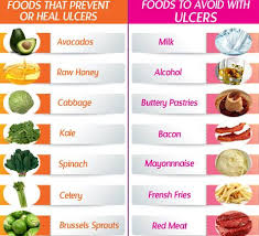 Foods To Eat And Avoid For Stomach Ulcers Ulcer Diet