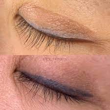remove permanent eyeliner benefits