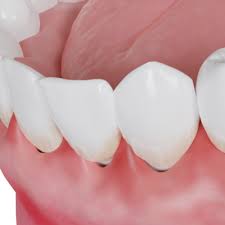 why are my gums swollen dental care