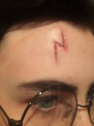 harry potter scar special effects
