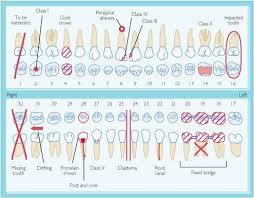 Dental Charting Form Dental Charting Dental Hygiene