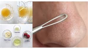 get rid of clogged oil glands on face