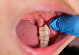 CDHP Dental Health Project gambar png