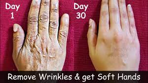 remove wrinkles from hands make your