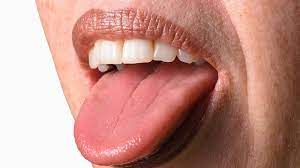 Da pickel auf der zunge bei jeder mundbewegsung schmerzen, ist eine schnelle behandlung unabdinglich. á… Pickel Auf Der Zunge