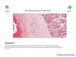 A quiz by rachel carr. Ppt Basic Histology Quiz Cartilage And Bone Powerpoint Presentation Id 2021145