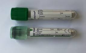 Alcohol Blood Sciences Test Exeter Clinical Laboratory