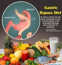 pre post gastric byp t foods to