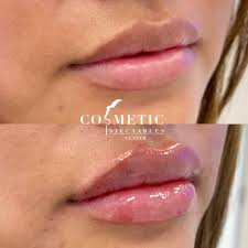 cosmeticinjectables com wp content uploads 2023 11
