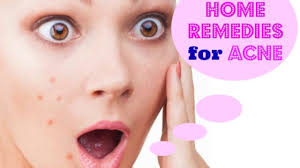 top 10 home remes to treat acne