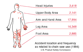 Logging Etool Chain Saw Chain Saw Injury Locations