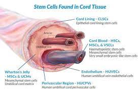 umbilical cord tissue stem cell banking