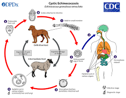 CDC - DPDx - Echinococcosis