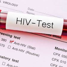 tested for confirmed hiv results