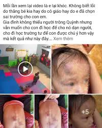 Bé gái 2 tuổi bị bạn đánh dã man trong lớp tại Bắc Giang: Phụ huynh có nên  dạy con cách tự vệ từ bé?