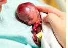 stillborn infant