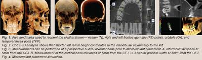 cbct clinical s in