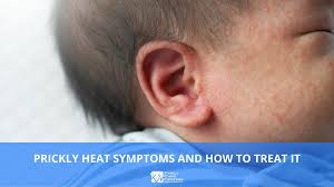 ly heat symptoms and how to treat it