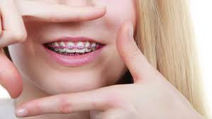 how braces can affect your face and jaw