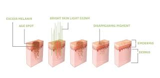 the benefits of green light therapy