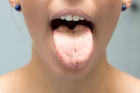 yeast infections of the lips and face