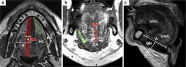 mri study landmarks of the floor