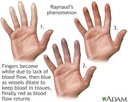 fingers that change color information