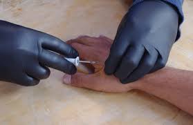 Image result for the rfid  chip is now