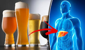 Kết quả hình ảnh cho alcohol and liver disease