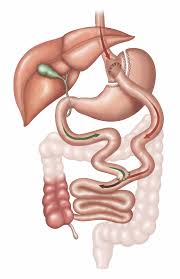 what is gastric byp surgery j j