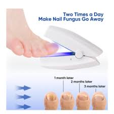 nail fungus treatment device with laser