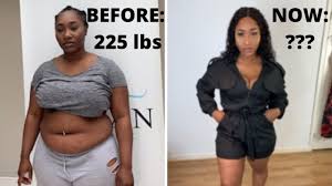 i had weight loss surgery my gastric