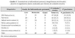 prenatal de hidronefrosis evaluados