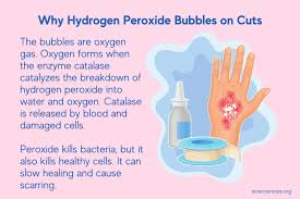 Why Does Hydrogen Peroxide Bubble On A Cut