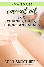 how to use coconut oil for wounds cuts