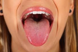 how to treat a tongue burn savina