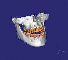cone beam ct in dental practice