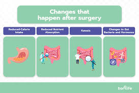 after gastric byp surgery