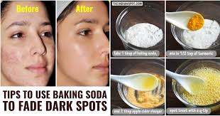 baking soda to fade dark spots